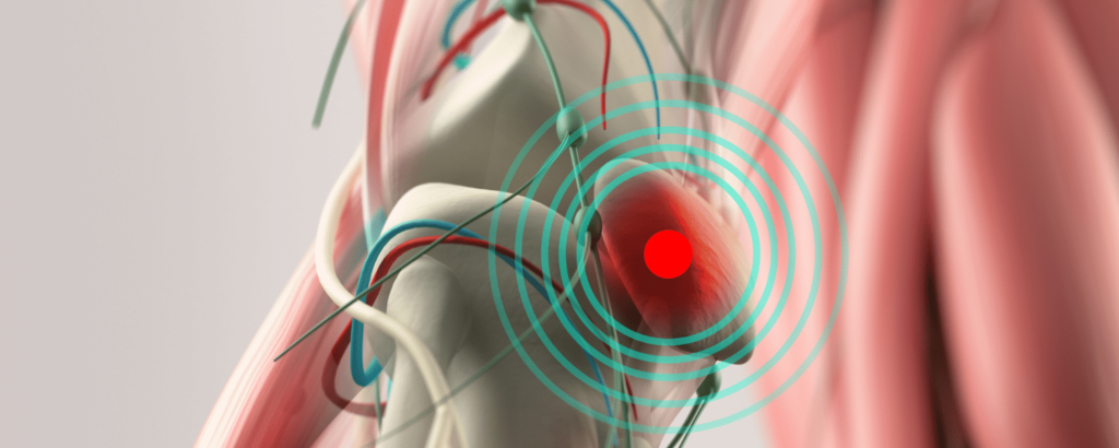 Joelho Condromalacia Patelar