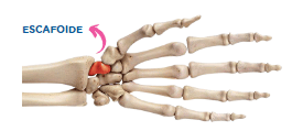 escafoide escafoide